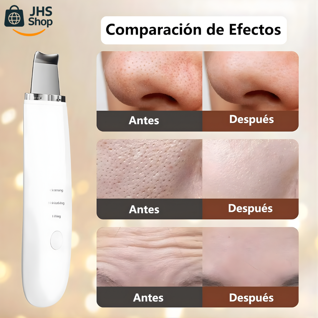 LIMPIADOR FACIAL ESPÁTULA PUNTOS NEGROS. 🧼👩🏻✨ ¡Limpia los puntos negros y logra un rostro radiante con el peeling facial ultrasónico!