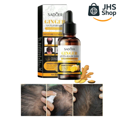SÉRUM DE JENGIBRE ANTI-CAÍDA DEL CABELLO Sadoer®. ¡Promueve el crecimiento y fortaleza de tu cabello!