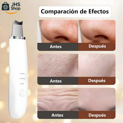 LIMPIADOR FACIAL ESPÁTULA PUNTOS NEGROS. 🧼👩🏻✨ ¡Limpia los puntos negros y logra un rostro radiante con el peeling facial ultrasónico!