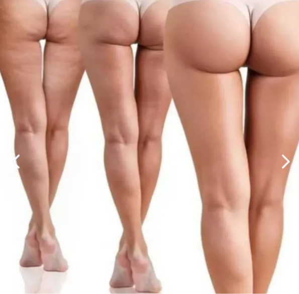 CREMA HIDRATANTE Y REAFIRMANTE PARA GLÚTEOS ¡Los hidrata, reafirma y levanta!